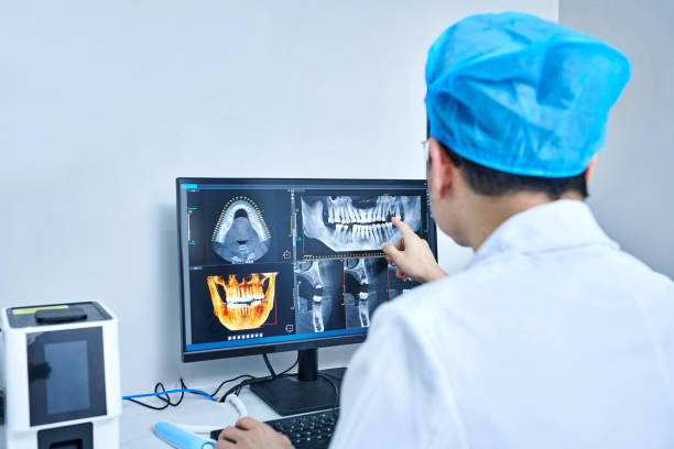 Best Emergency Tooth Extraction in Spring, TX